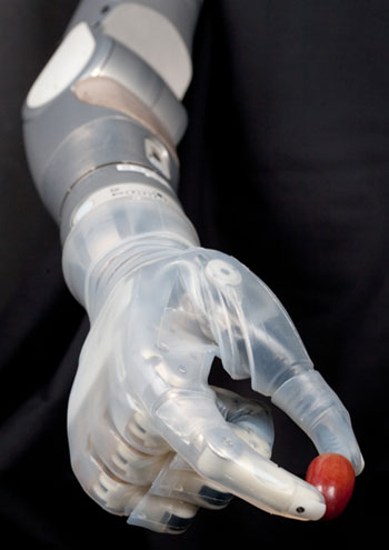prosthetic arm